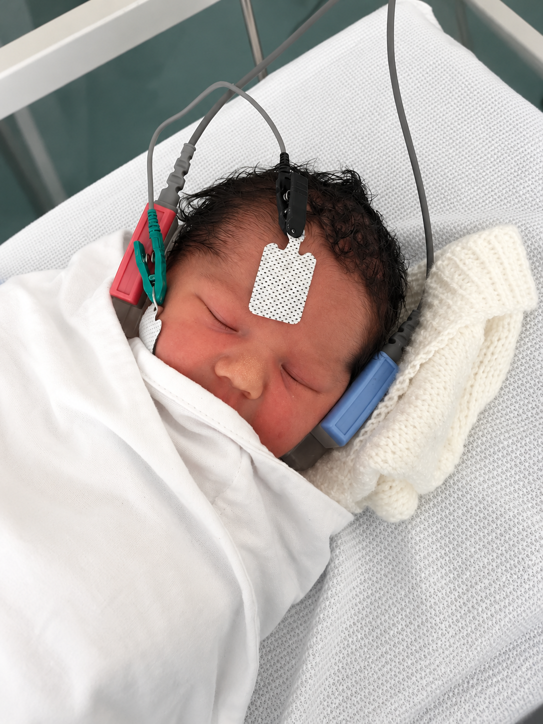 Newborn baby having AABR hearing screen with sensors on head and soft earphones, settled and asleep